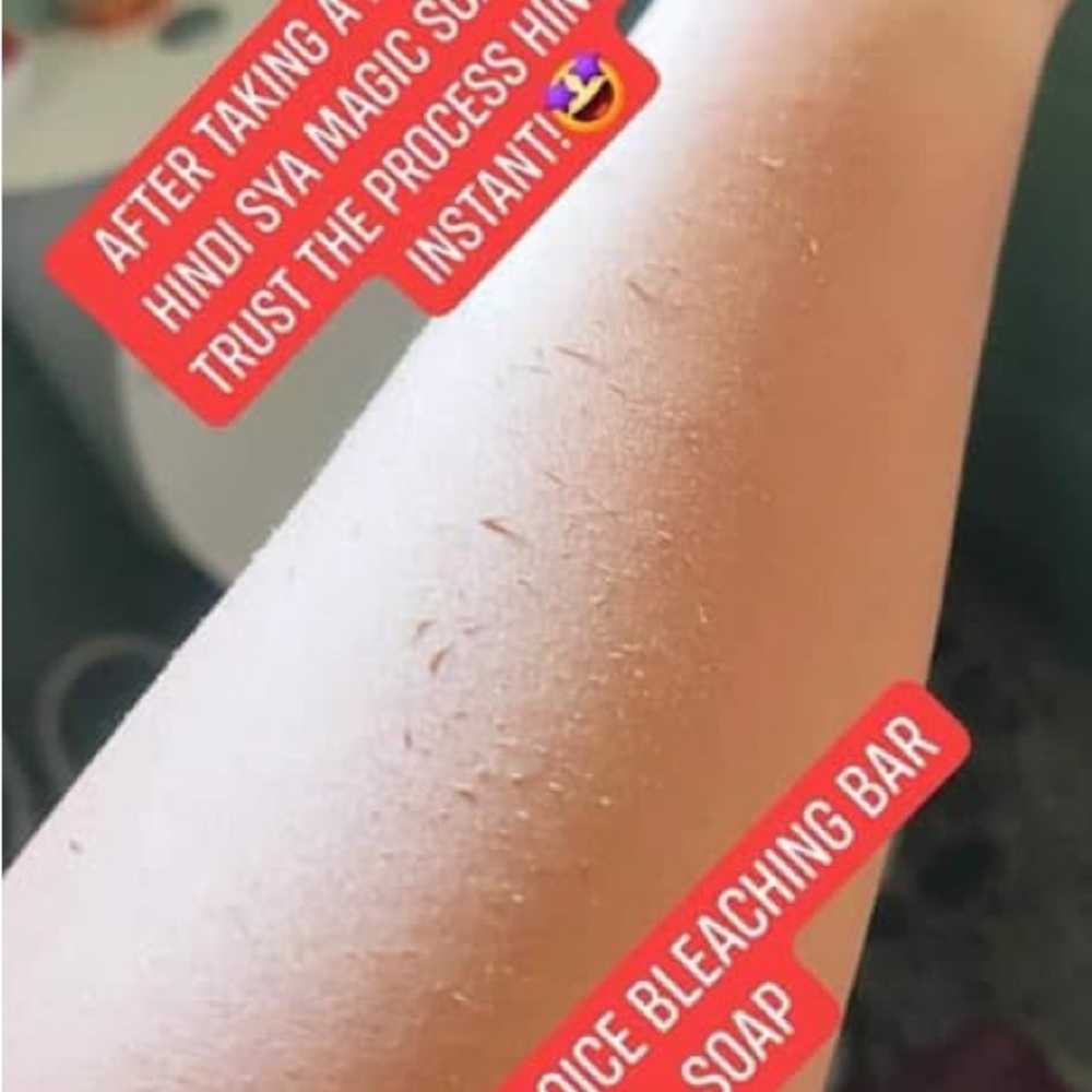 HER Choice Ph INTENSE BLEACHING BAR SOAP. - Picture 6 of 15